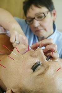 Facial Enhancement and Medical Acupuncture 725395 Image 0
